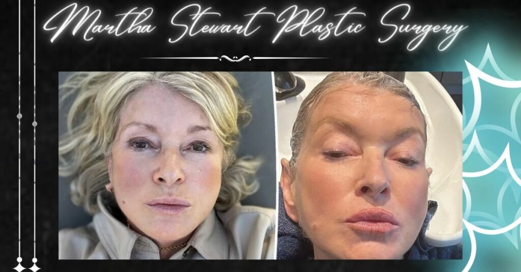 Martha Stewart Plastic Surgery